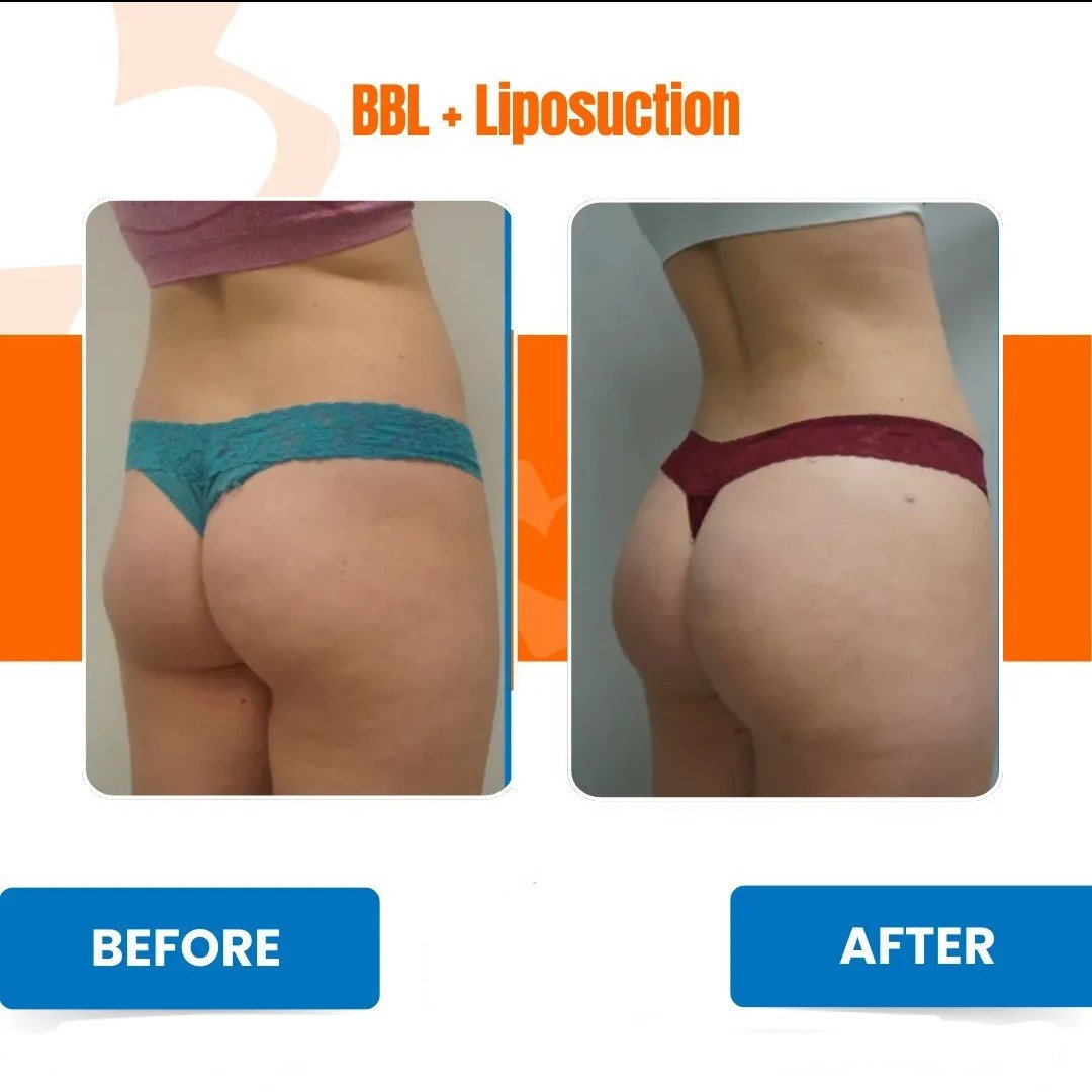 WhatsApp Image 2026-01-26 at 4.19.20 PM